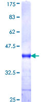 12.5% SDS-PAGE Stained with Coomassie Blue.